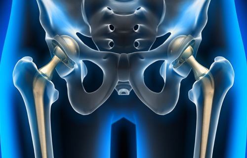 Best Joint Replacement Surgeon in Gurgaon